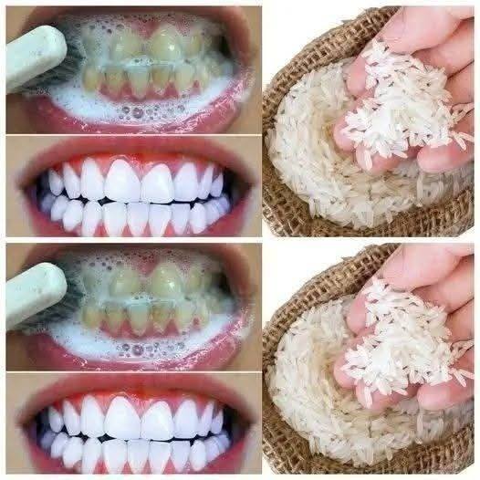 How to Think Critically About DIY Tooth-Whitening Trends