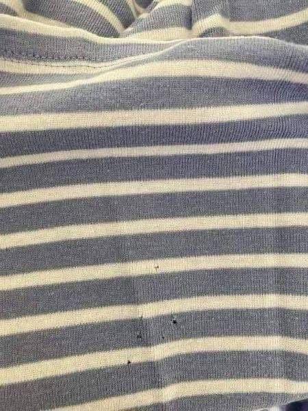 Why Small Holes Appear in Clothes—and How to Prevent Them