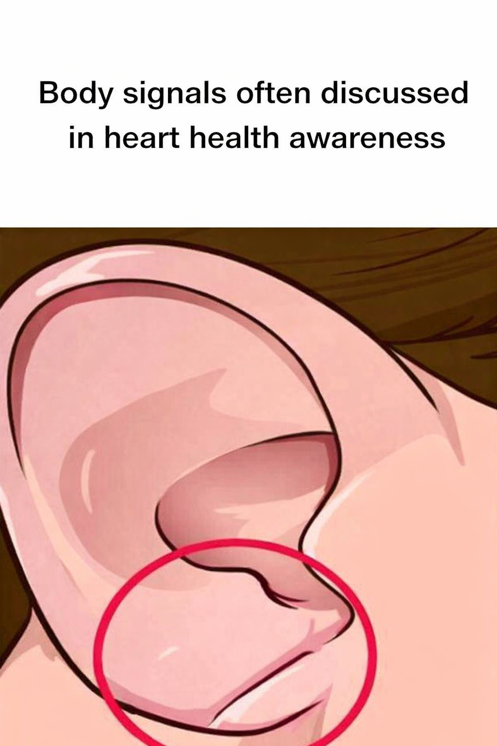 Understanding Artery Health: Awareness, Balance, and Early Attention