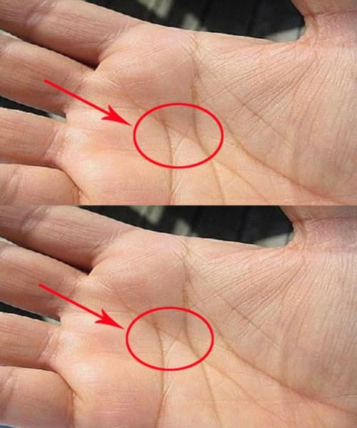 The “M” on Your Palm: What It Symbolizes About Love and Commitment