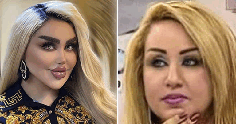 A Viral Transformation and the Conversation Around Modern Beauty