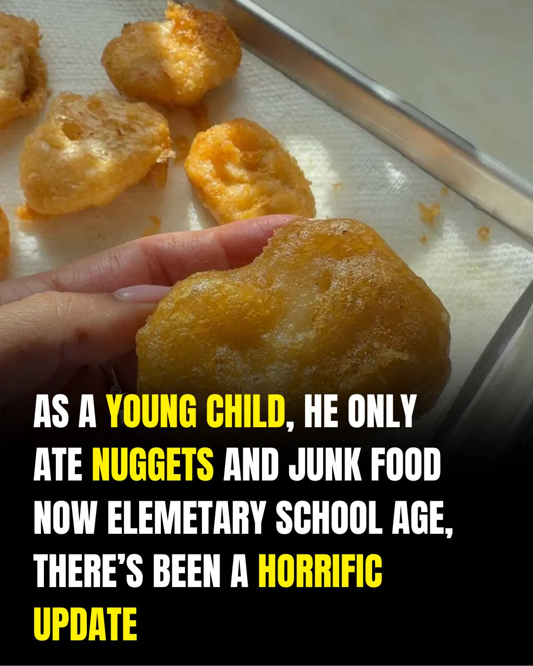 A Childhood Nutrition Wake-Up Call: Why Balanced Diets Matter for Vision