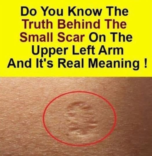 A Small Mark with a Big Story: What That Circular Scar Represents