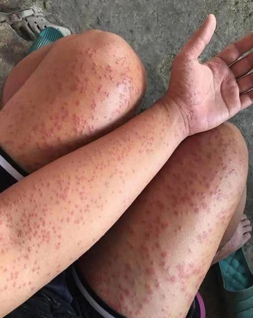 When Your Skin Sends Signals: A Simple Guide to Understanding Nighttime Irritations