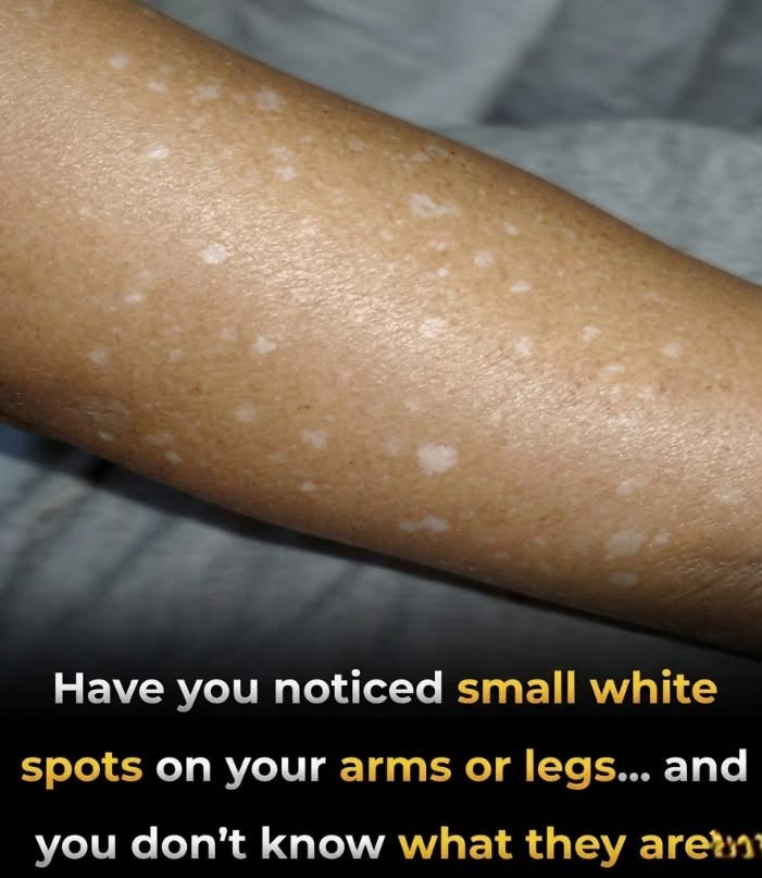 Understanding White Spots on Skin: A Practical Guide to Nutrition and Care