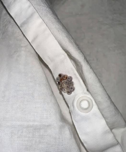 An Unusual Morning Discovery: What Those Tiny Beads Might Be