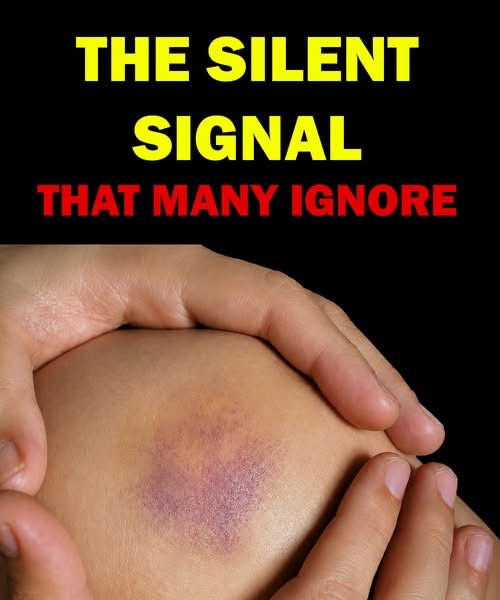 Understanding Common Leukemia Symptoms and the Importance of Early Medical Attention