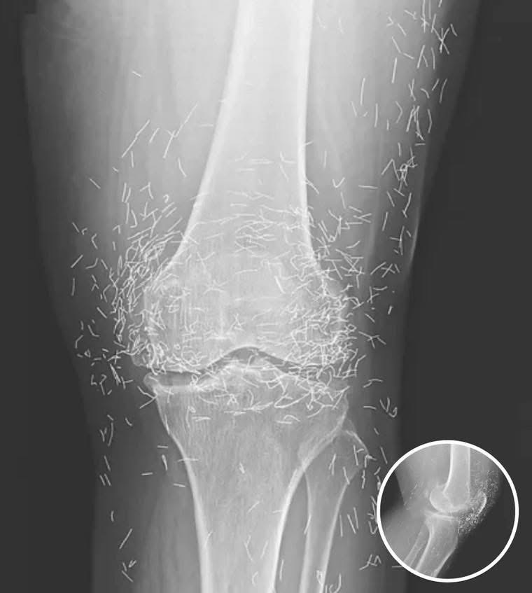 A Rare Medical Case Sparked New Conversations About Traditional and Modern Treatments