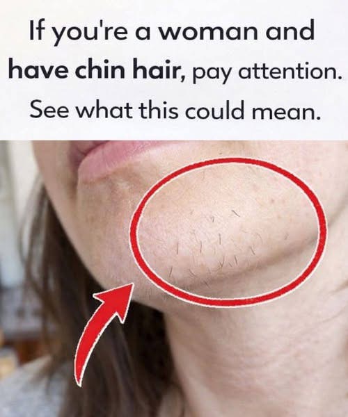 Understanding Why Some Women Develop Chin Hair Over Time