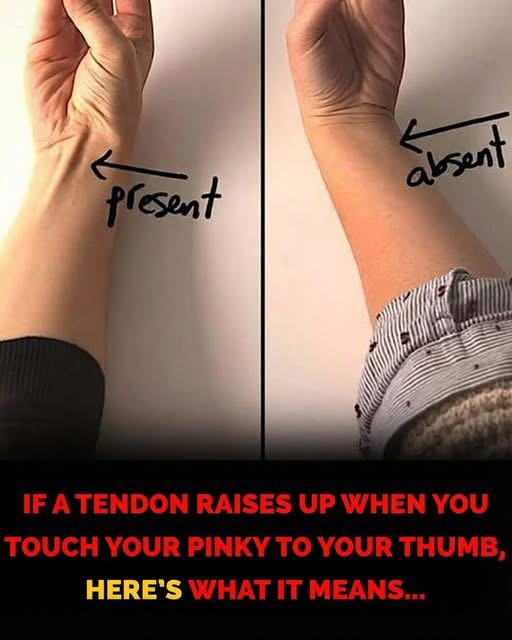 A Small Wrist Tendon Quietly Reveals Part of Human Evolution