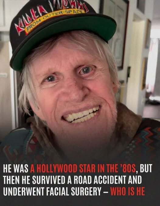 Gary Busey’s Extraordinary Journey Through Fame, Recovery, and Reinvention