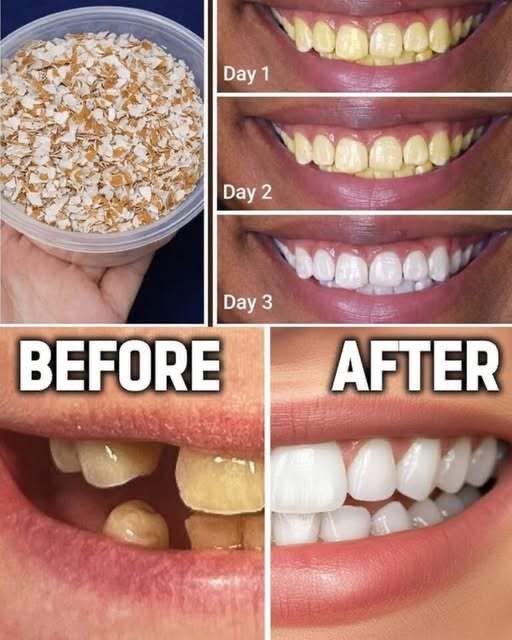 Can Eggshell Powder Support a Brighter Smile? What to Know Before You Try It