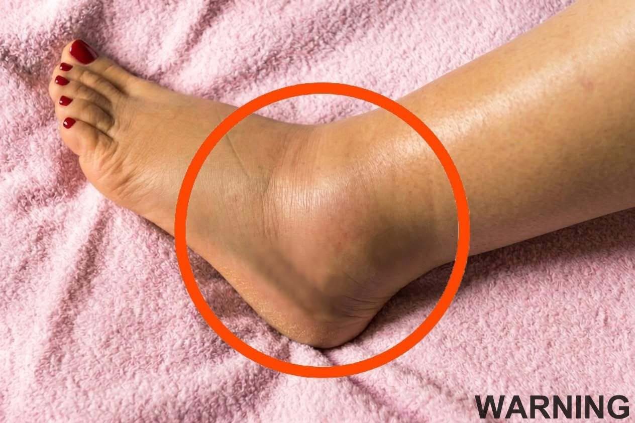 Understanding Swollen Feet: Practical Steps to Support Everyday Comfort and Wellness