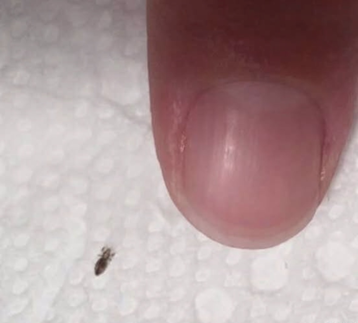 How to Handle Head Lice Effectively and Keep Them from Returning