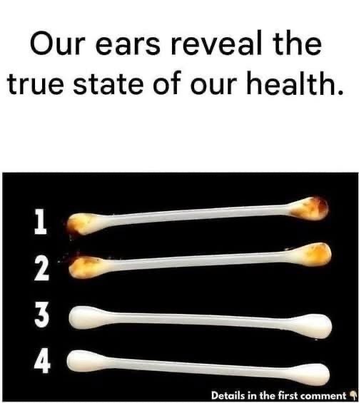 What Your Earwax Can Reveal About Your Overall Well-Being