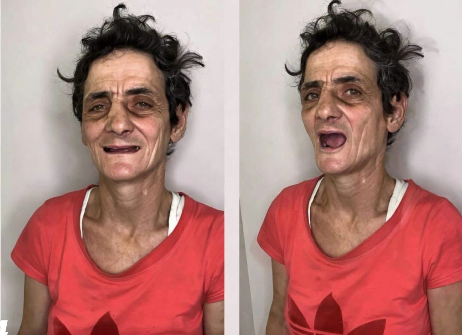 A Compassionate Makeover That Restored Confidence and Renewed Hope