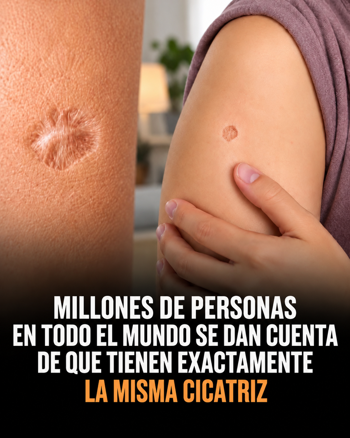 La pequeña cicatriz que millones de personas llevan en el brazo tiene una explicación histórica